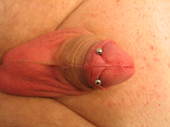 Frenulum