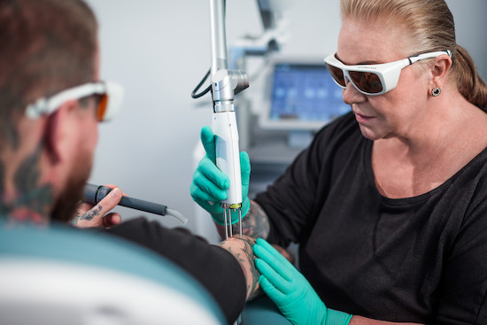 News: 11 Jahre Erfahrung in der Tattoo- und PMU-Entfernung trifft Spitzentechnologie!