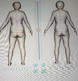 News: Möchten Sie Ihre Fettzellen entspannt und angenehm im Liegen verlieren? (12.05.2018)