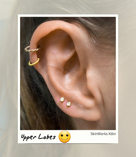 News: Upper Lobes