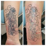 News: Tattoos - wenn sie nicht für immer bleiben sollen. (28.06.2018)