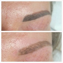 Entfernung von Permanent Make-up