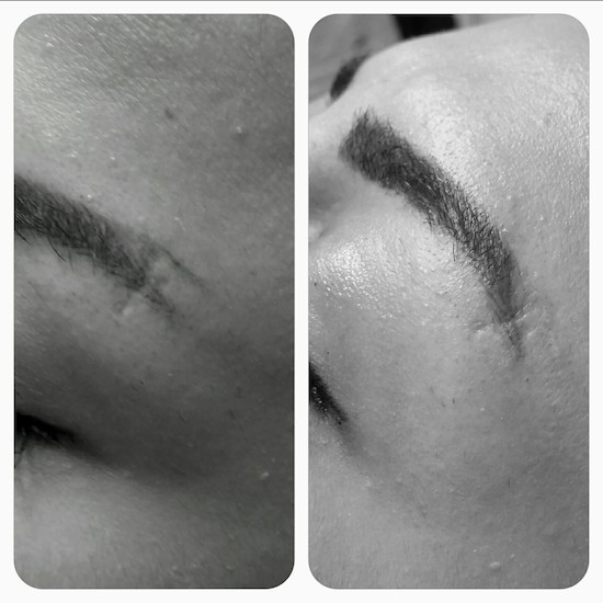News: Ist beim Permanent Make Up etwas schief gegangen?