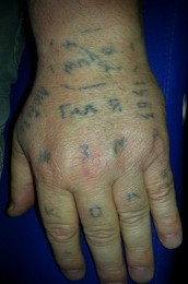 Laien-Tattoo auf dem Handrücken, vorher und nachher.